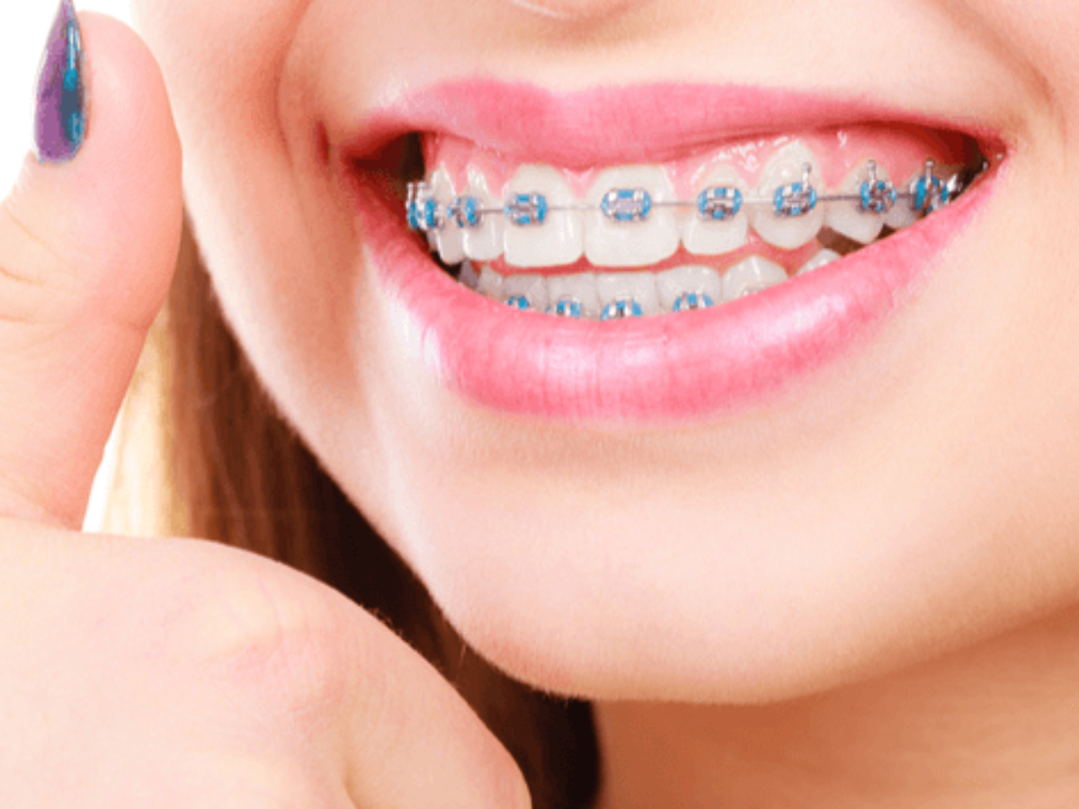 christmas tree brush for braces
