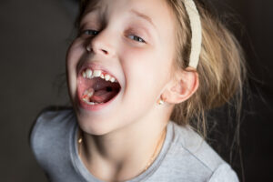 Benefits of Early Orthodontic Treatment You Can't Afford to Miss